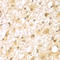 RUN And FYVE Domain Containing 2 antibody, A13178, Boster Biological Technology, Immunohistochemistry paraffin image 