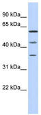 PHD Finger Protein 23 antibody, TA339153, Origene, Western Blot image 