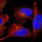 Quinone oxidoreductase PIG3 antibody, HPA022012, Atlas Antibodies, Immunofluorescence image 