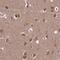 Zinc Finger Protein 219 antibody, NBP2-31626, Novus Biologicals, Immunohistochemistry frozen image 