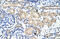 Potassium Voltage-Gated Channel Subfamily A Regulatory Beta Subunit 2 antibody, ARP37678_P050, Aviva Systems Biology, Immunohistochemistry paraffin image 