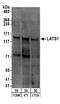 WARTS antibody, A300-478A, Bethyl Labs, Western Blot image 