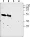Cholinergic Receptor Nicotinic Alpha 7 Subunit antibody, TA328885, Origene, Western Blot image 