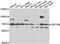 Zinc Finger Protein 169 antibody, A15089, Boster Biological Technology, Western Blot image 