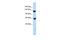 SWI/SNF Related, Matrix Associated, Actin Dependent Regulator Of Chromatin, Subfamily A, Member 1 antibody, PA5-41440, Invitrogen Antibodies, Western Blot image 