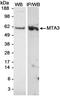 Metastasis Associated 1 Family Member 3 antibody, A300-160A, Bethyl Labs, Western Blot image 