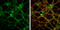 Glutamate Ionotropic Receptor NMDA Type Subunit 2B antibody, GTX133099, GeneTex, Immunocytochemistry image 