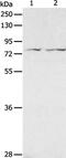 ADAM Metallopeptidase Domain 20 antibody, PA5-50304, Invitrogen Antibodies, Western Blot image 