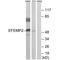 EGF-containing fibulin-like extracellular matrix protein 2 antibody, A05653, Boster Biological Technology, Western Blot image 