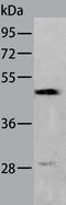HAR antibody, TA321778, Origene, Western Blot image 