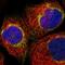 Mitochondrial Fission Regulator 1 antibody, HPA023152, Atlas Antibodies, Immunocytochemistry image 