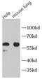 Beclin 1 antibody, FNab10414, FineTest, Immunohistochemistry frozen image 