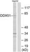 DEAD-Box Helicase 51 antibody, GTX87946, GeneTex, Western Blot image 