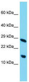 Chromosome 11 Open Reading Frame 52 antibody, TA333558, Origene, Western Blot image 