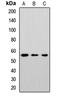 Cholesterol 24-hydroxylase antibody, LS-C668339, Lifespan Biosciences, Western Blot image 