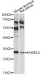 Rhomboid Like 2 antibody, LS-C749407, Lifespan Biosciences, Western Blot image 
