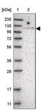 TBC1 Domain Family Member 2 antibody, NBP1-87335, Novus Biologicals, Western Blot image 