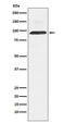 Dyn3 antibody, M06890, Boster Biological Technology, Western Blot image 