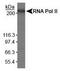 RNA Polymerase II Subunit A antibody, TA309814, Origene, Western Blot image 