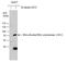 HCV antibody, GTX131273, GeneTex, Western Blot image 
