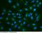 Olfactomedin 4 antibody, 11639-MM12, Sino Biological, Immunohistochemistry paraffin image 