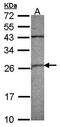 Glutathione S-Transferase Alpha 4 antibody, orb69752, Biorbyt, Western Blot image 