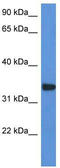 Holocytochrome C Synthase antibody, TA343104, Origene, Western Blot image 