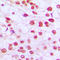 RB Transcriptional Corepressor 1 antibody, LS-C352774, Lifespan Biosciences, Immunohistochemistry paraffin image 
