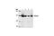 Phospholipase C Gamma 2 antibody, 3872T, Cell Signaling Technology, Western Blot image 