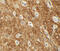 Rho Associated Coiled-Coil Containing Protein Kinase 2 antibody, 6297, ProSci Inc, Immunohistochemistry paraffin image 