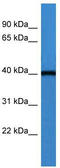 ARSA antibody, TA342875, Origene, Western Blot image 