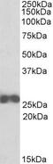 Rho GDP Dissociation Inhibitor Beta antibody, GTX88059, GeneTex, Western Blot image 
