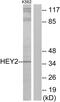 Hairy/enhancer-of-split related with YRPW motif protein 2 antibody, GTX87082, GeneTex, Western Blot image 