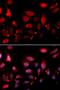 Rac GTPase-activating protein 1 antibody, orb167212, Biorbyt, Immunocytochemistry image 