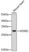Homeobox B1 antibody, 22-357, ProSci, Western Blot image 
