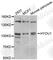 Hypoxia Up-Regulated 1 antibody, A6625, ABclonal Technology, Western Blot image 