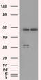 Protein Phosphatase 5 Catalytic Subunit antibody, TA500571, Origene, Western Blot image 