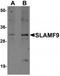 SLAM family member 9 antibody, TA320066, Origene, Western Blot image 
