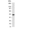 Ectodysplasin A antibody, R30638, NSJ Bioreagents, Western Blot image 