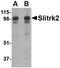 SLIT And NTRK Like Family Member 2 antibody, orb74935, Biorbyt, Western Blot image 