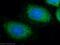 Ankyrin Repeat Domain 49 antibody, 25034-1-AP, Proteintech Group, Immunofluorescence image 