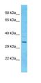 Keratin 76 antibody, orb327016, Biorbyt, Western Blot image 