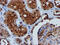 F-Box Protein 21 antibody, M13227, Boster Biological Technology, Immunohistochemistry paraffin image 