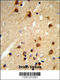 Centromere protein K antibody, 63-891, ProSci, Immunohistochemistry paraffin image 