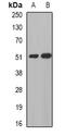Mannosyl (Alpha-1,3-)-Glycoprotein Beta-1,2-N-Acetylglucosaminyltransferase antibody, orb341061, Biorbyt, Western Blot image 