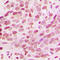 Histone H3 antibody, LS-C354337, Lifespan Biosciences, Immunohistochemistry paraffin image 