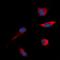 c-met antibody, orb315613, Biorbyt, Immunocytochemistry image 