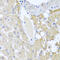 Sulfotransferase Family 1A Member 1 antibody, 16-367, ProSci, Immunohistochemistry paraffin image 