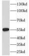 EMAP Like 2 antibody, FNab02757, FineTest, Western Blot image 