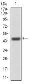 Fibroblast Growth Factor Receptor 3 antibody, NBP2-52468, Novus Biologicals, Western Blot image 